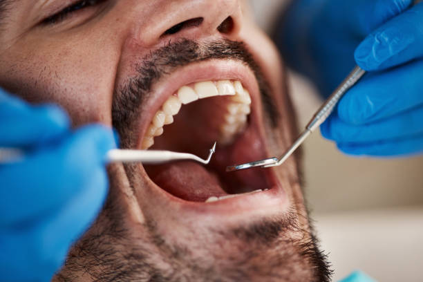 Best Emergency Dental Care for Broken or Chipped Teeth in Wood River, NE