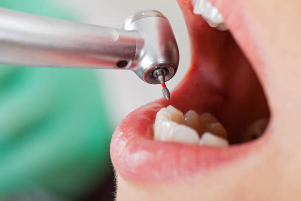Best Emergency Dental Care for Broken or Chipped Teeth in Wood River, NE